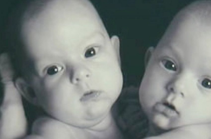  Fourteen years ago, surgeons separated Siamese twins. How they live now