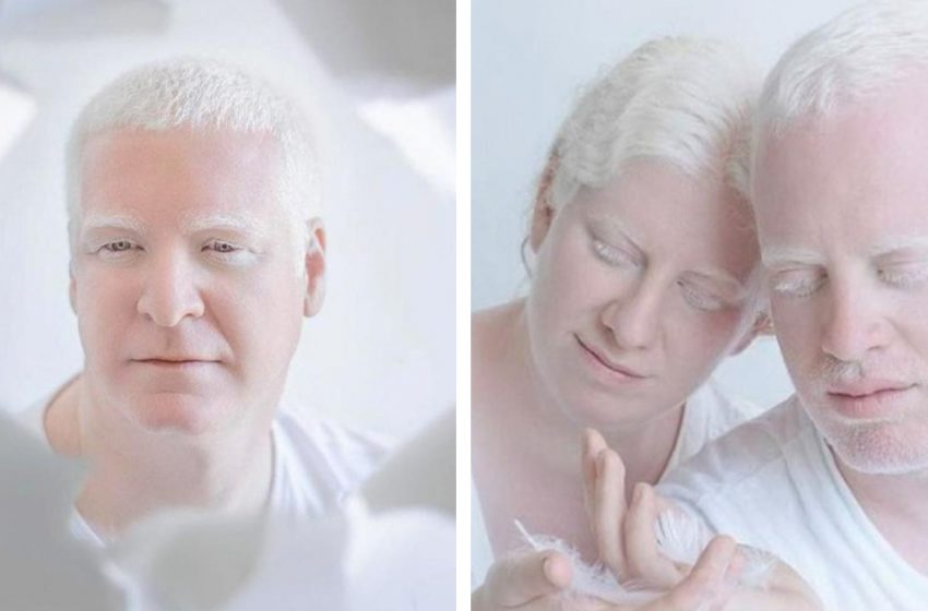  “Unreal Beauty”: An Israeli Photographer Has Created an Amazing Series Of Pictures Of Albino People!
