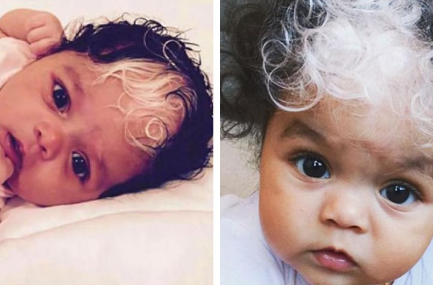  This Baby Was Born With a Snow-White Strand Of Hair: She Surprised Everyone Except Her Mother!